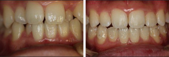 Orthodontics 2