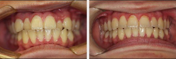 Orthodontics 3