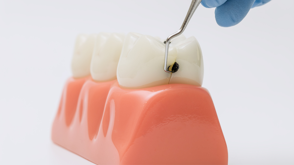A smile with a before and after comparison of teeth whitening. One side is yellow, the other white.