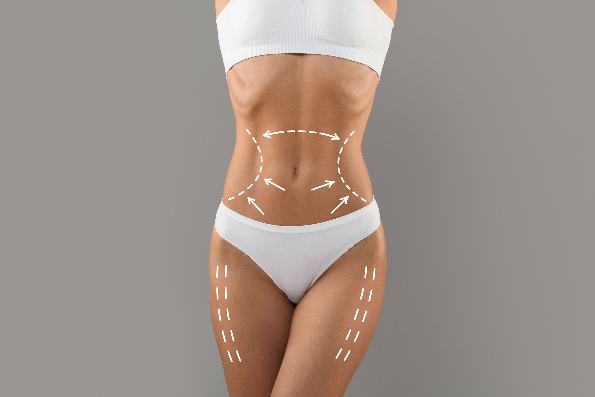 Woman in white lingerie with dotted lines and arrows on her body, suggesting cosmetic surgery.