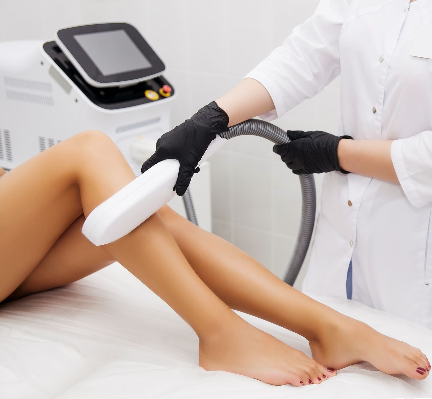 Laser hair removal procedure on a leg in a medical setting.