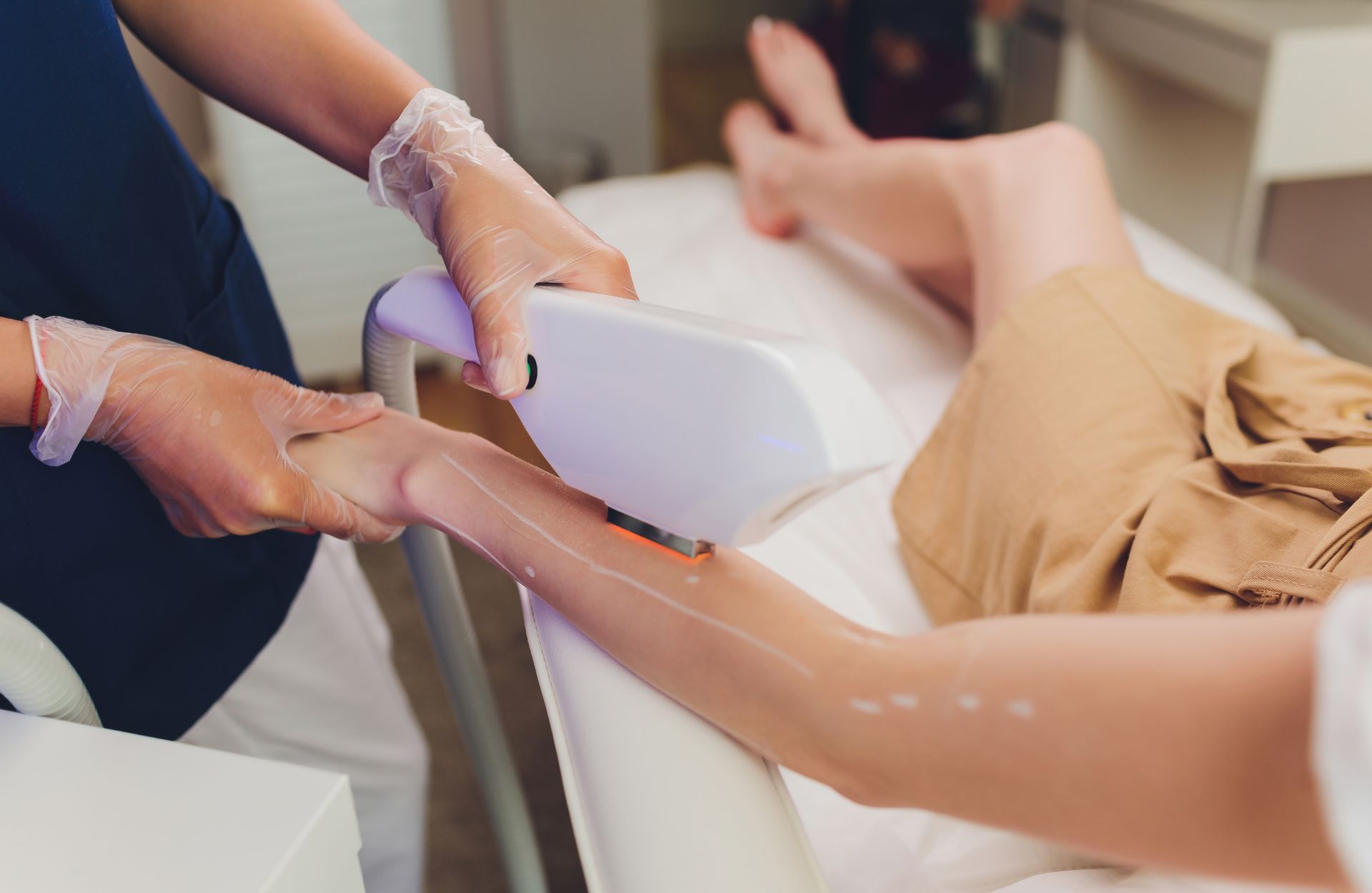 a woman is getting a laser hair removal treatment on her arm .
