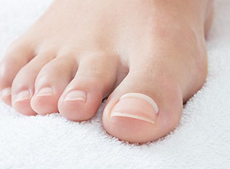 Nail Correction System — Country Podiatry in South Tamworth, NSW