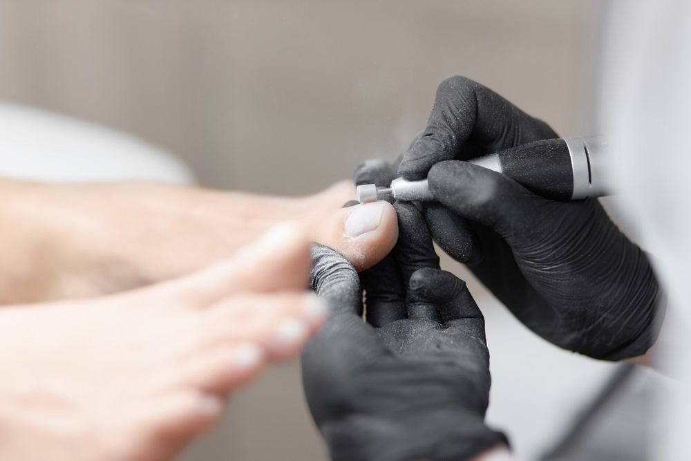 Nail Cleaning — Country Podiatry in South Tamworth, NSW