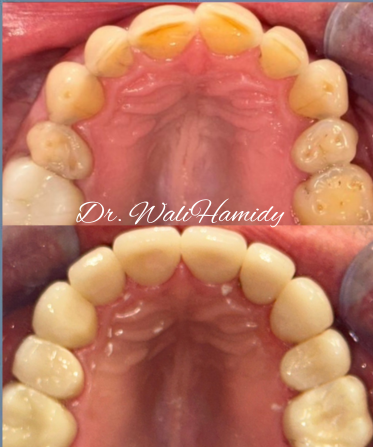 A picture of a person 's teeth taken by dr. wali hamidy