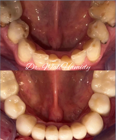 A picture of a person 's teeth taken by dr. wal hemudy