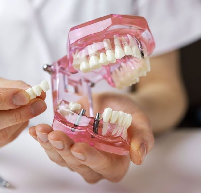 A person is holding a pink model of teeth in their hands.