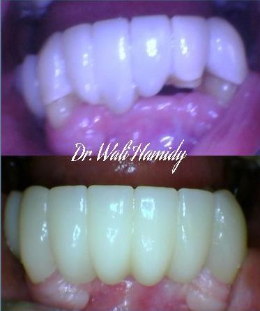 A picture of a person 's teeth taken by dr. hamidy