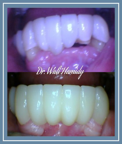 A picture of a person 's teeth taken by dr. hamidy