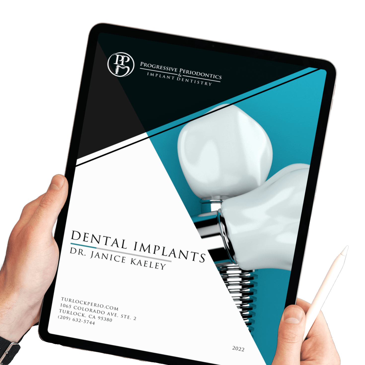 Dental Implants on Ipad | Top Dentist for Implants Turlock CA 95380