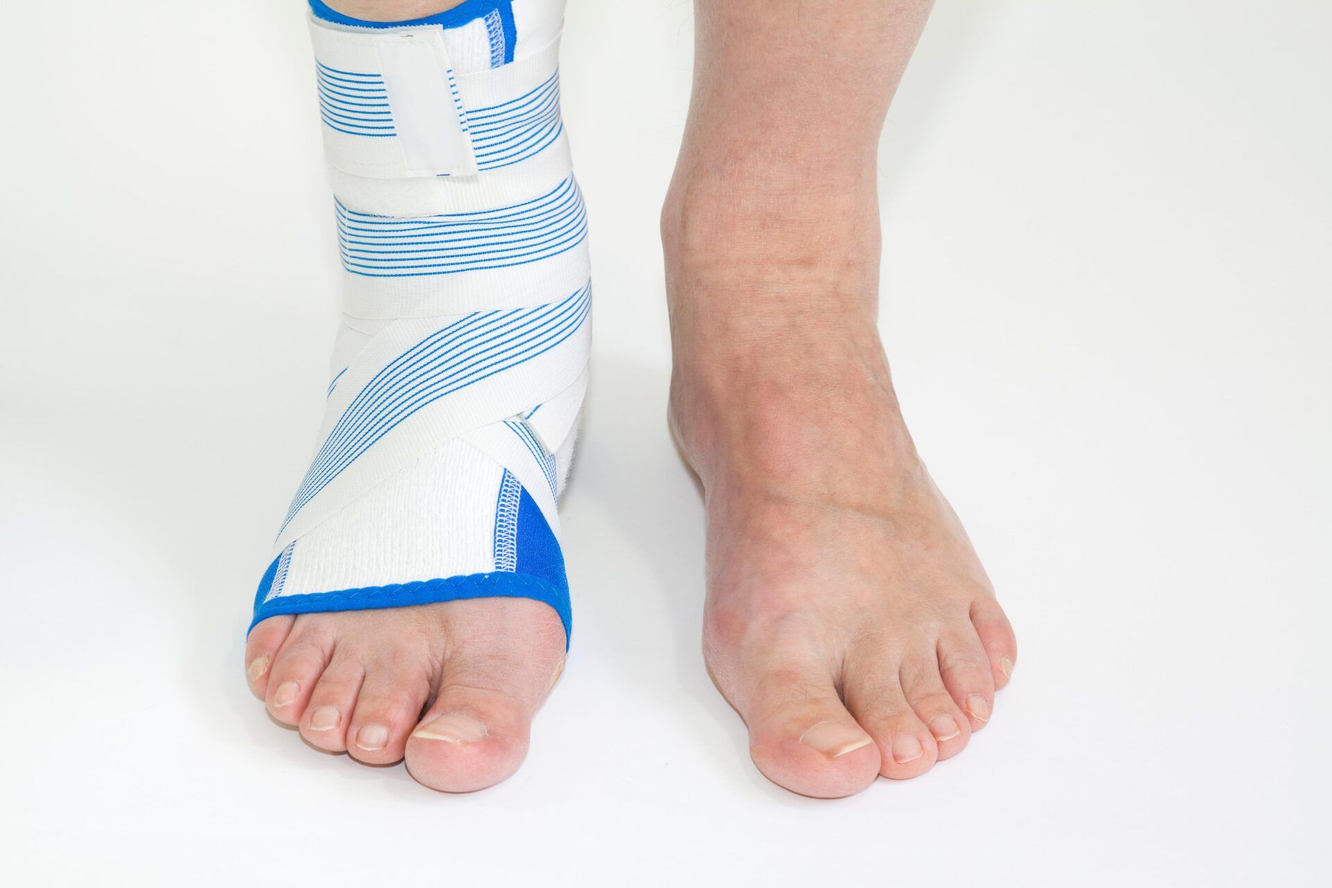 Fractured Foot — King County, WA — Ankle And Foot Specialists Of Puget Sound