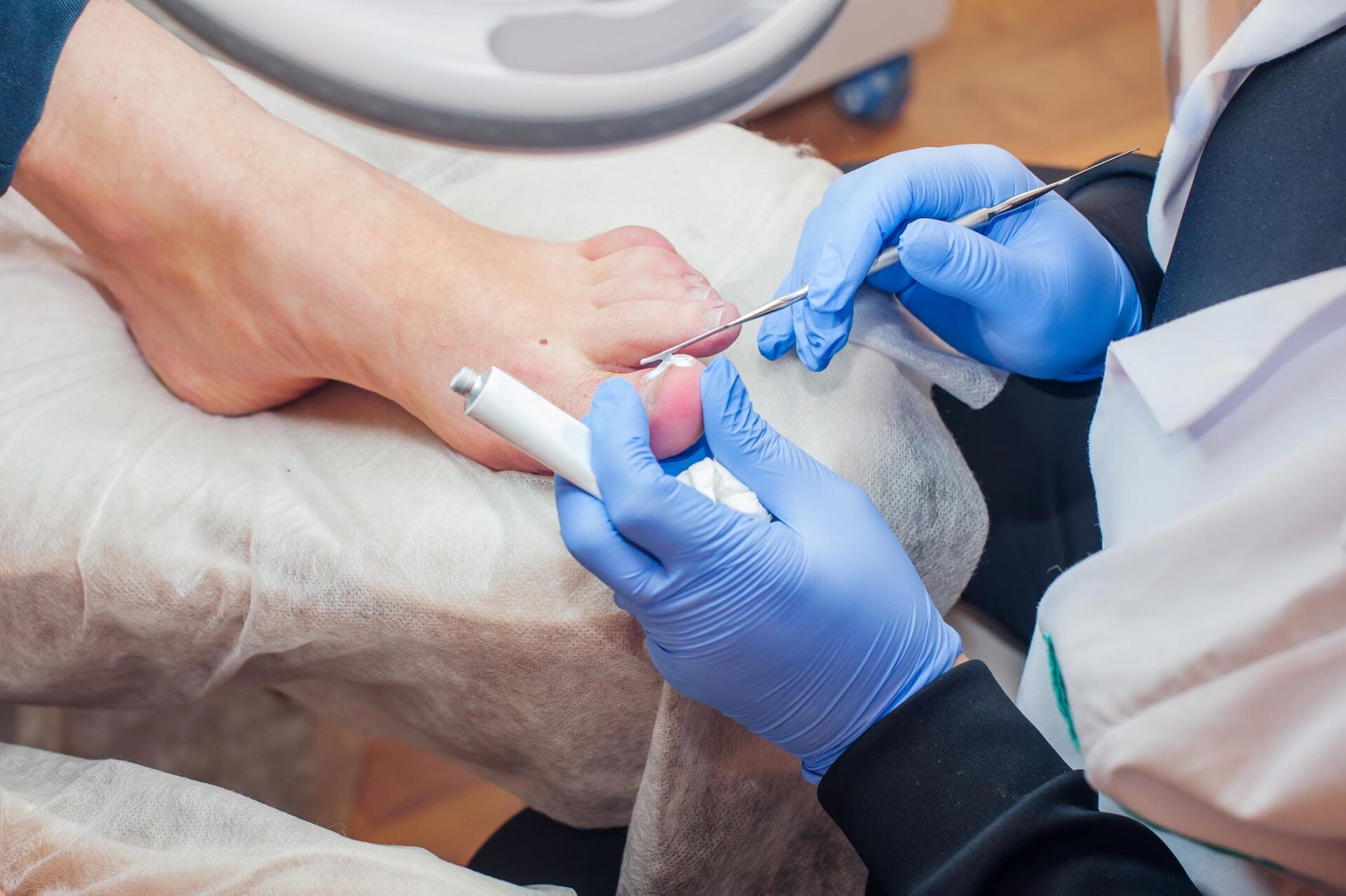 Applying Ointment Cream For Fungi — King County, WA — Ankle And Foot Specialists Of Puget Sound