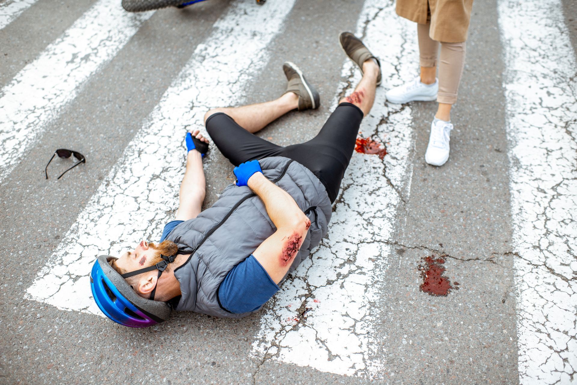 Cyclist injured on a crosswalk after a crash, with blood visible. A person in beige coat looks on.