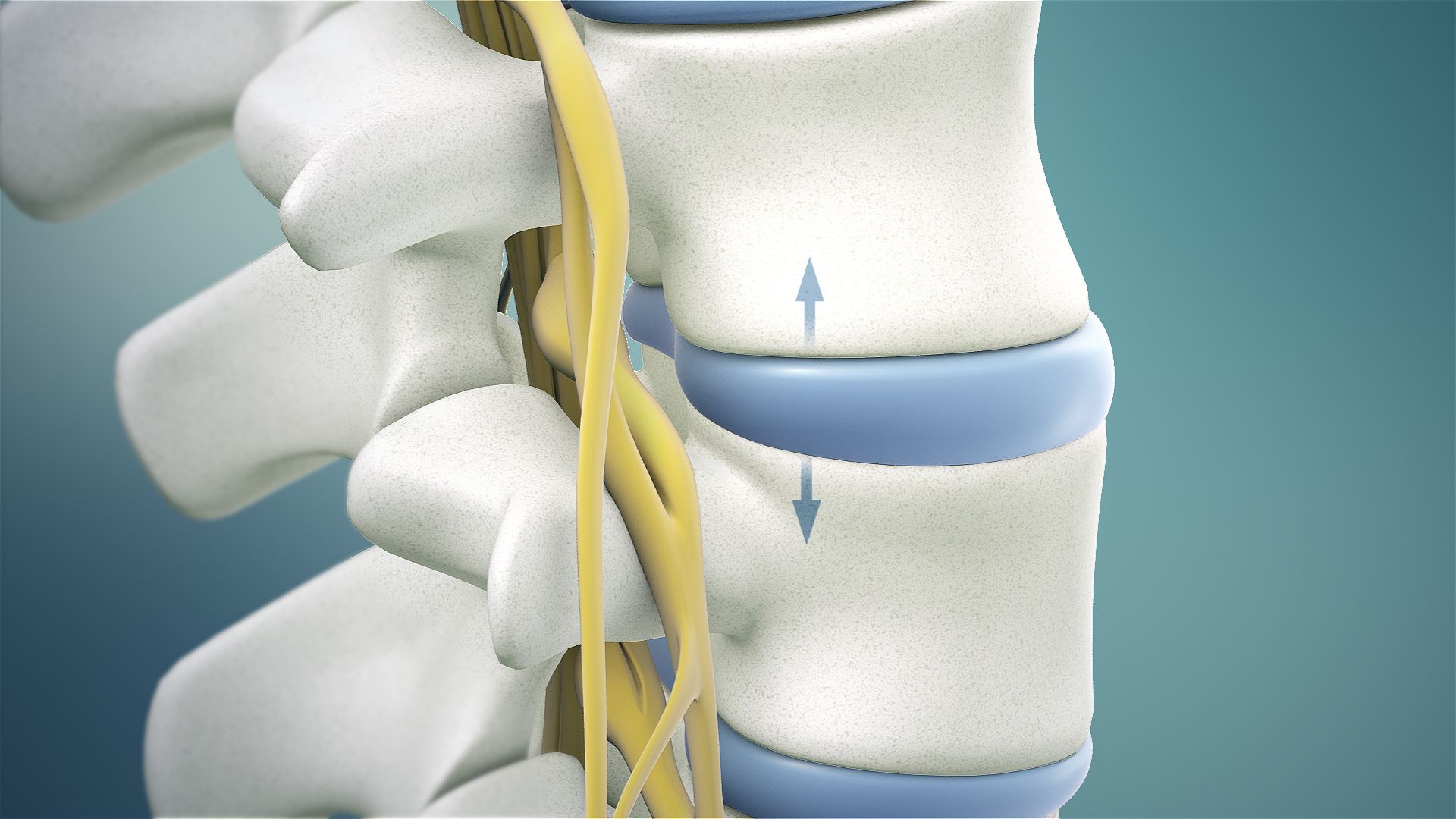 spinal decompression