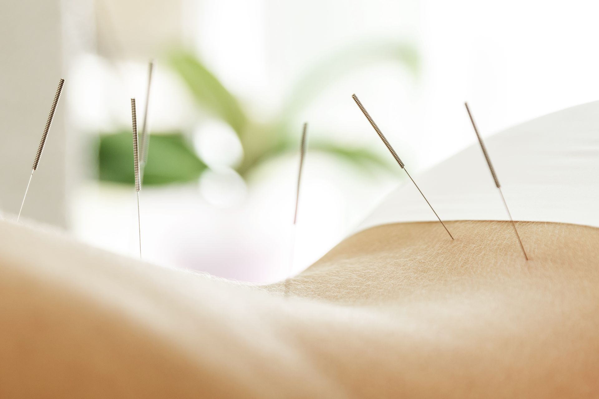 man prepping legs for acupuncture