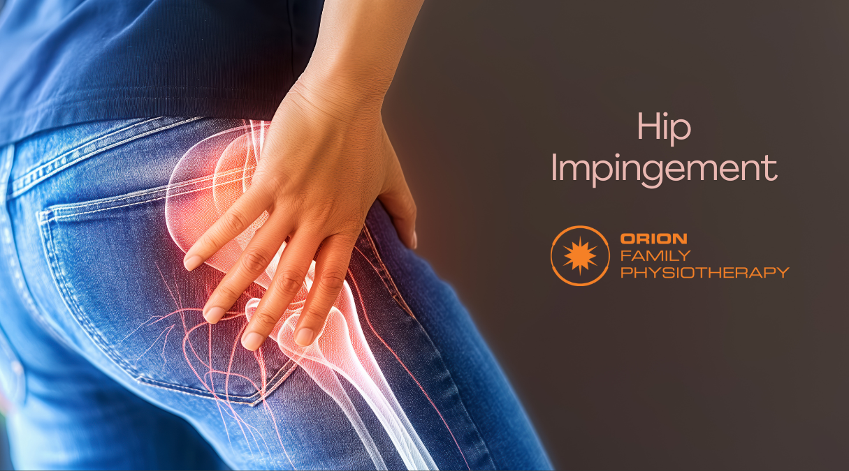 Hip Impingement - Springfield Central, QLD - Orion Family Physiotherapy