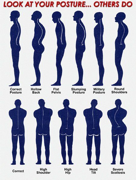 posture chart