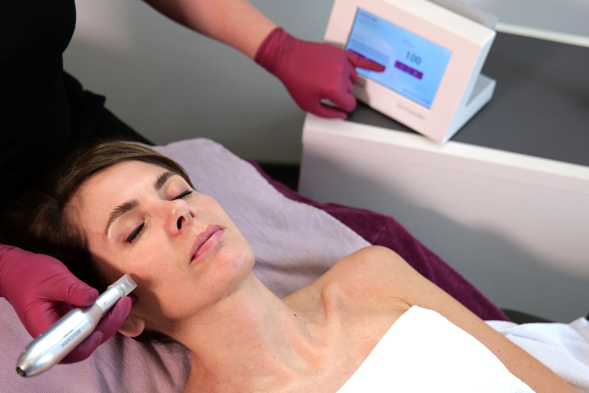 Microneedling
