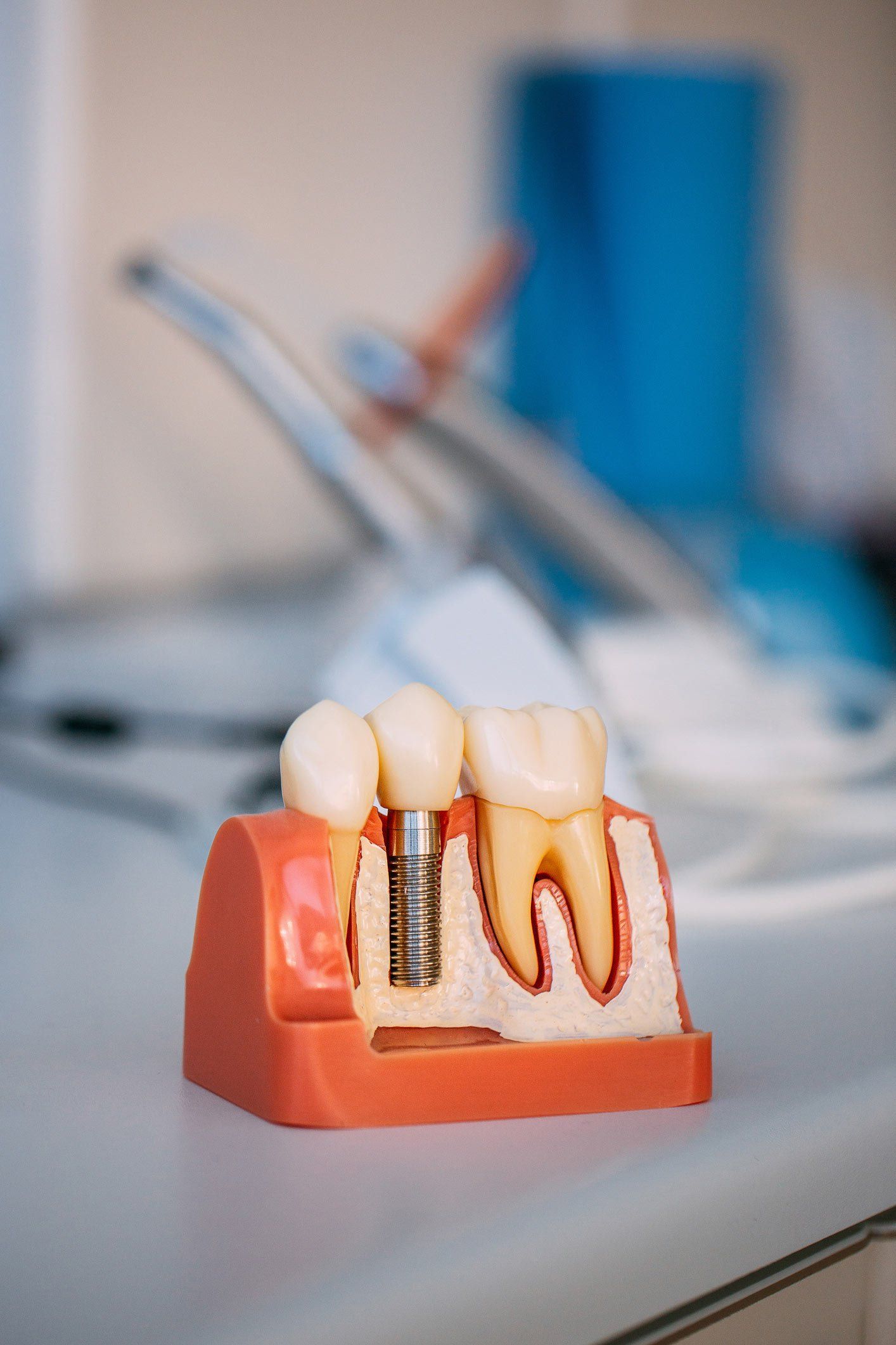 Teeth model | Ringwood, VIC | Abstract Arch Denture Clinic