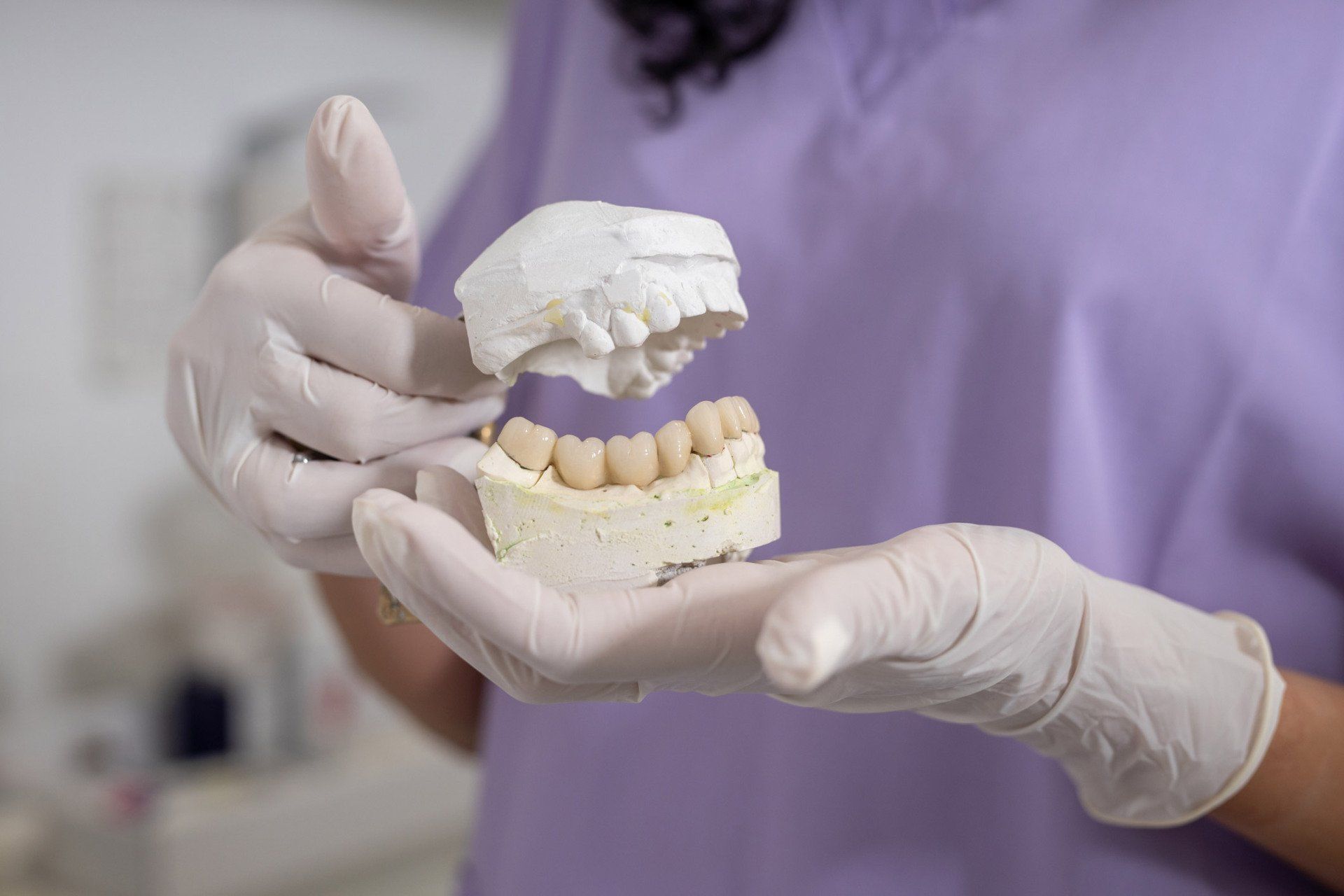 Dentist with gloves holding dental prosthetic | Ringwood, VIC | Abstract Arch Denture Clinic