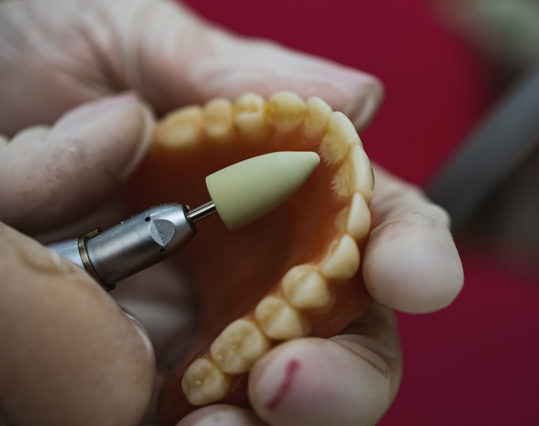 A tool used to shape a prosthesis tooth | Ringwood, VIC | Abstract Arch Denture Clinic
