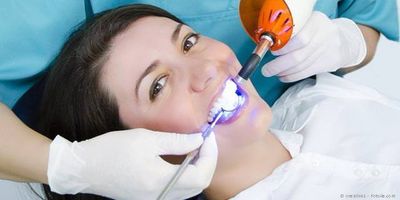 Schnellere Zahnaufhellung mit Licht-Aktivierung