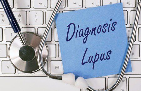 lupus, oral health