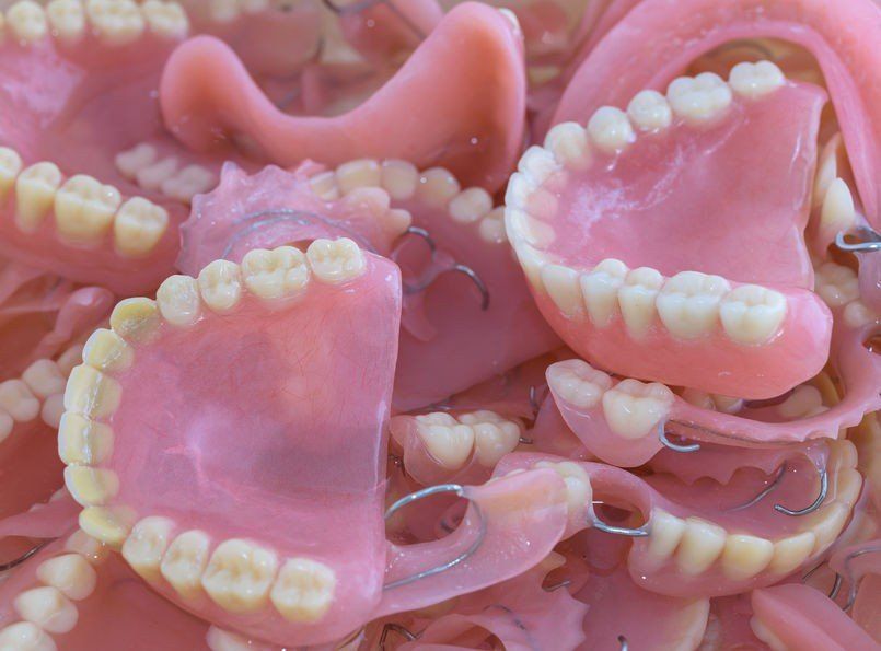 dentures or implants