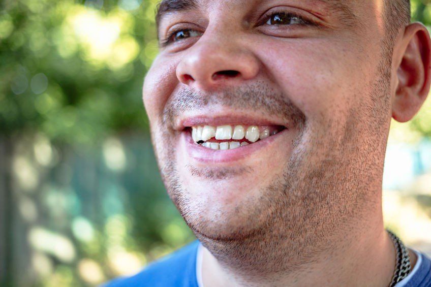 How to Properly Treat Jagged Teeth