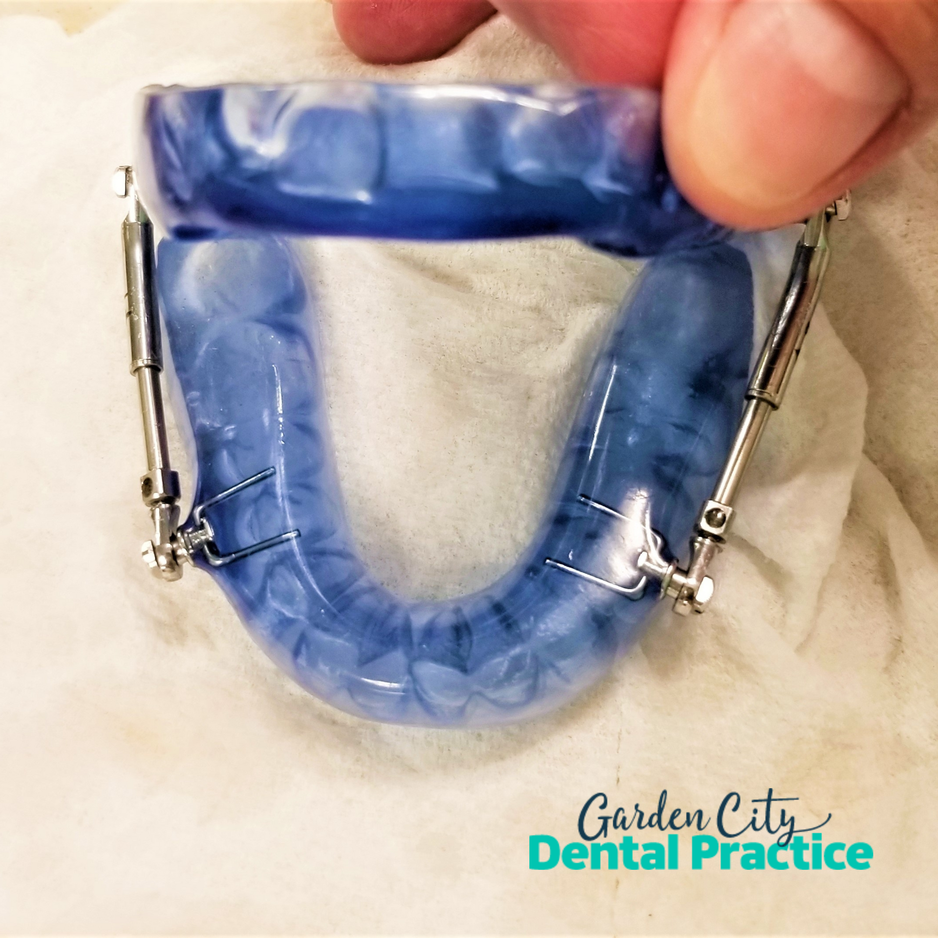 Obstructive Sleep Apnea Treatment in Toowoomba with Mandibular Oral Device at Garden City Dental Practice