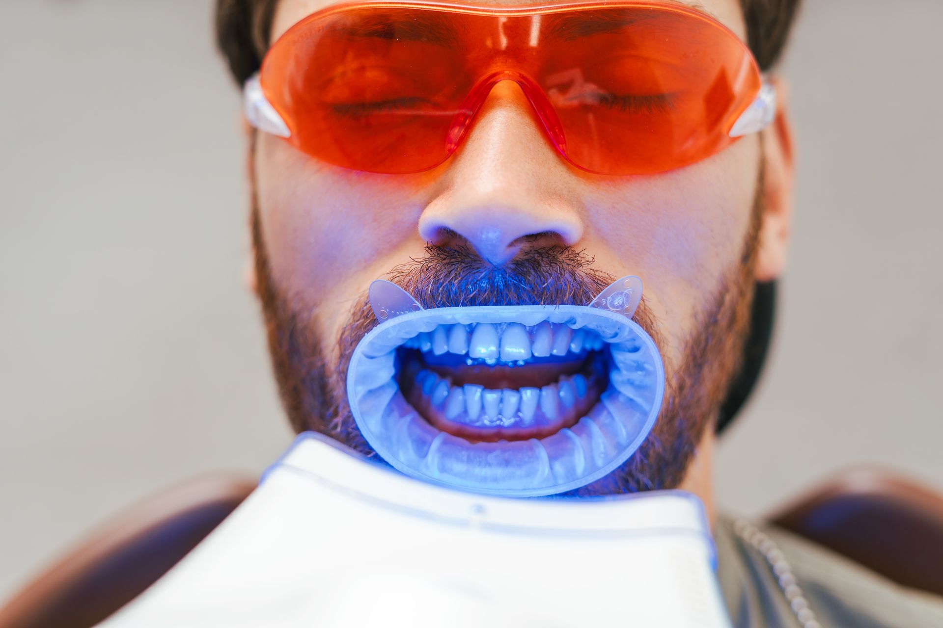 Bearded man receiving professional teeth whitening with gel activated by LED light at dental clinic near Wilsonton, QLD