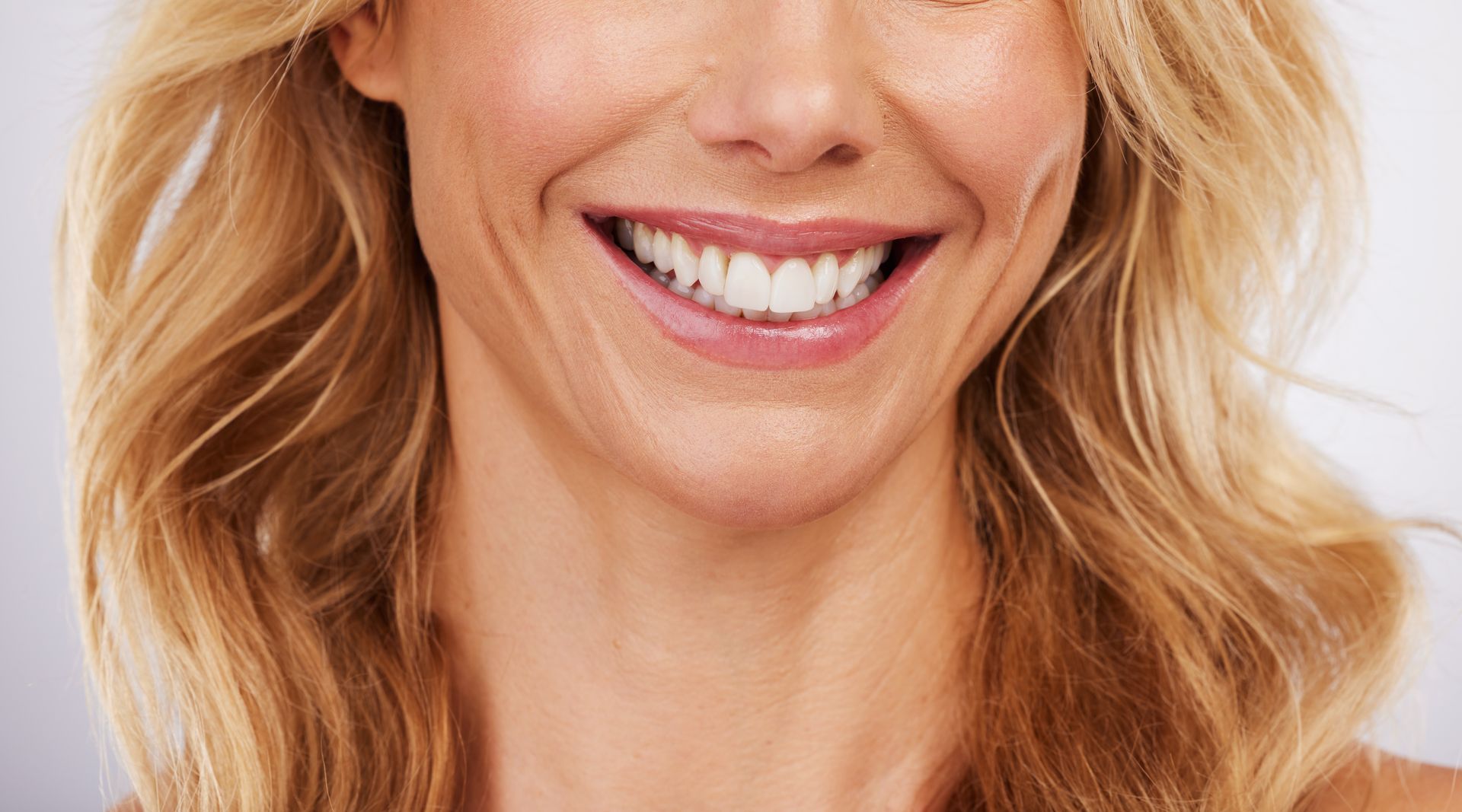 Close-up smile of woman smiling with dental crowns