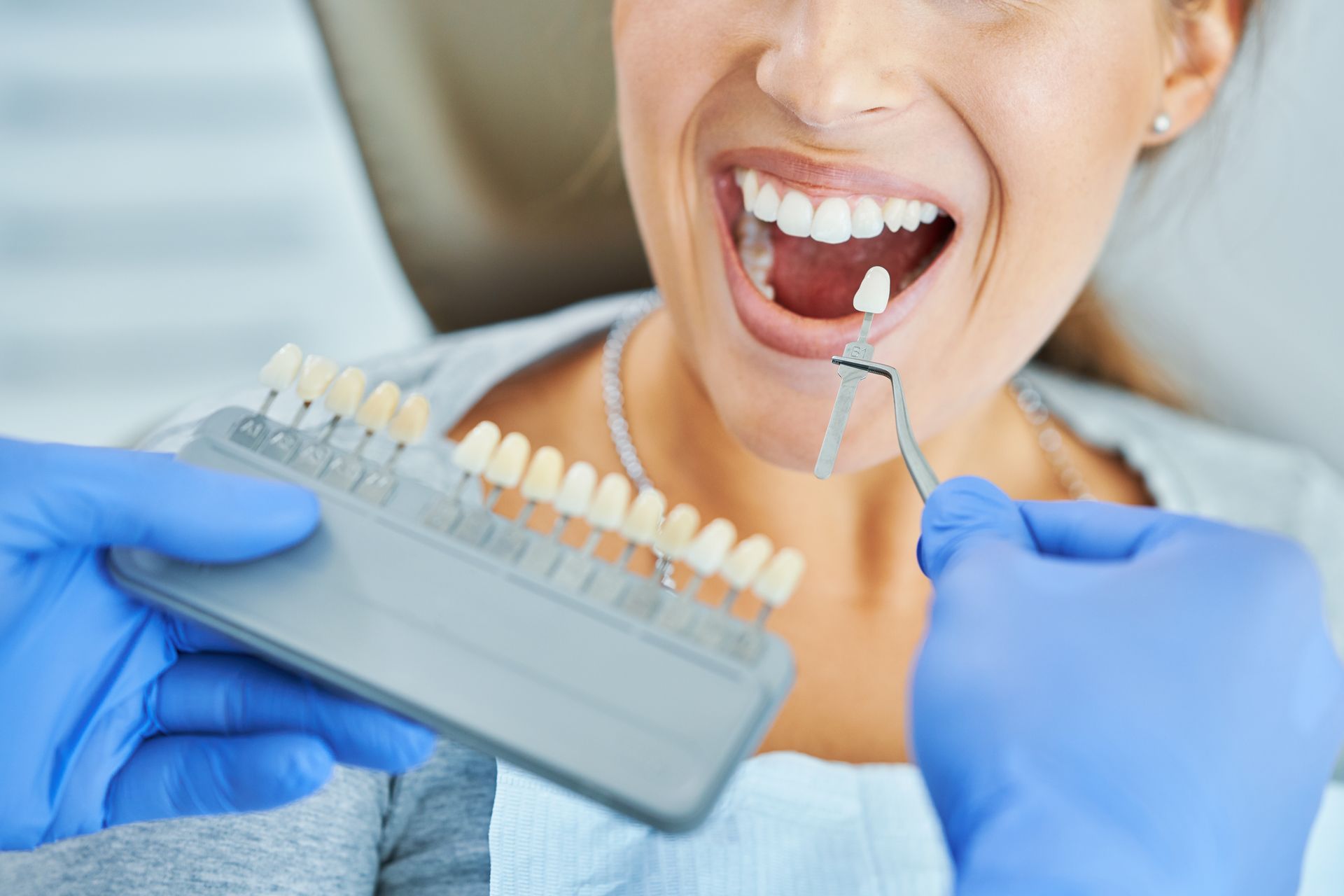 Smiling female patient at a Wilsonton Heights dental clinic having tooth shade matched for dental veneers or cosmetic crowns by a dentist using a shade guide