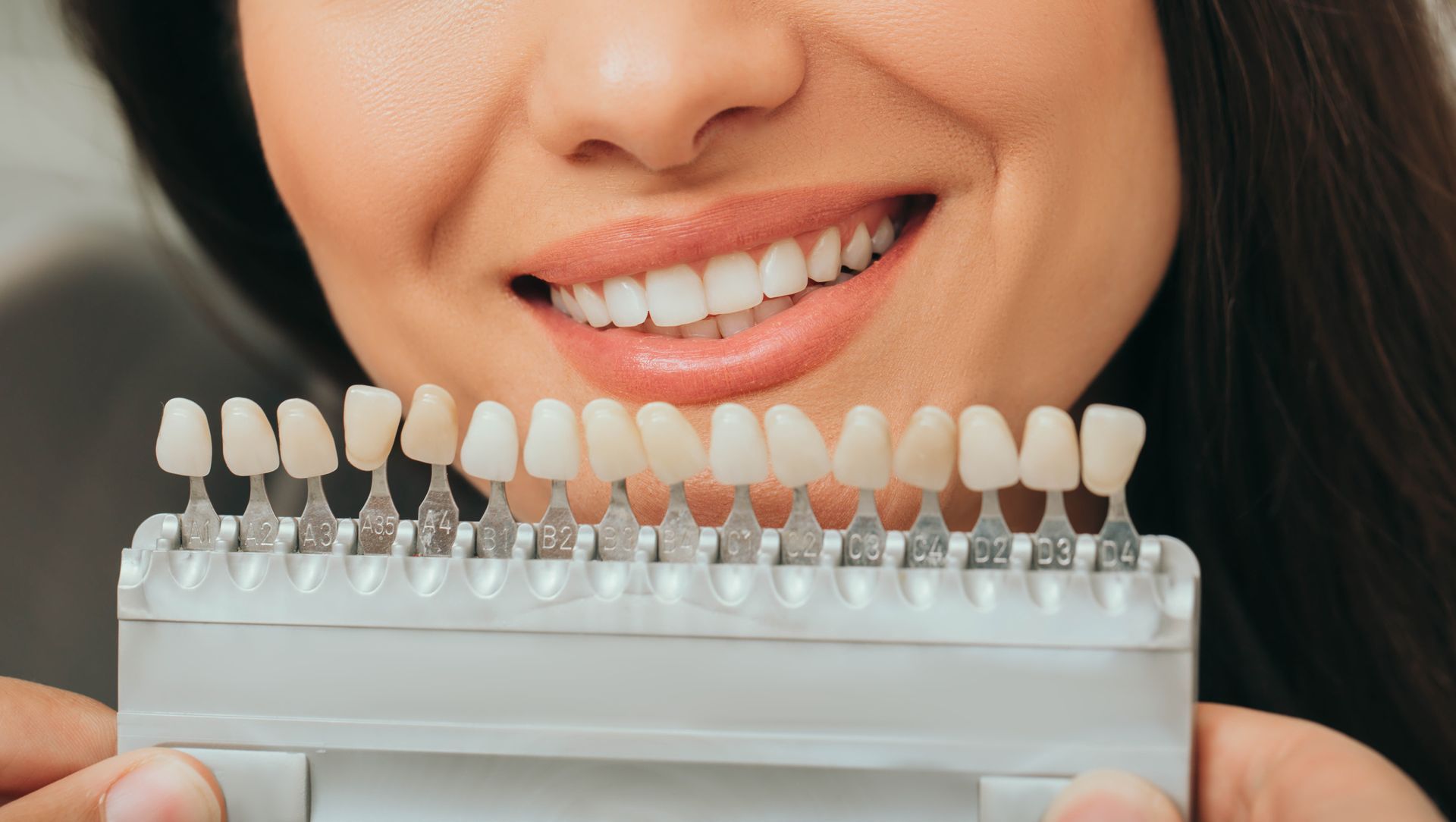 Close-up of woman’s teeth next to shade guide showing 5x whiter teeth after professional whitening in Wilsonton