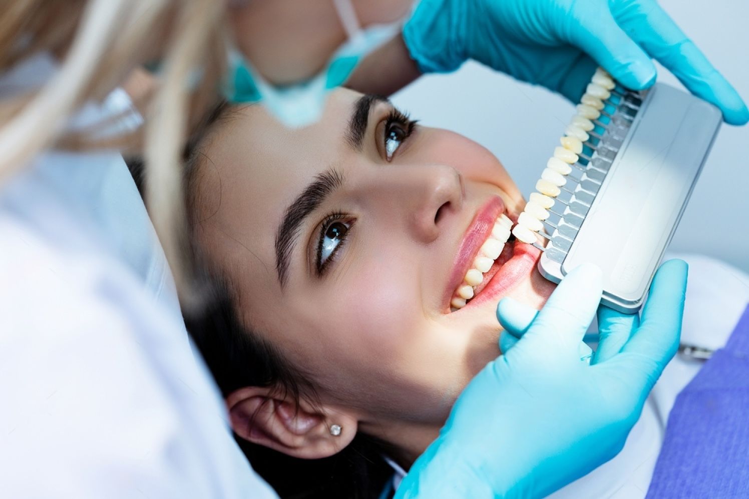 teeth whitening beautiful smile and white teeth of a young woman matching the shades of the natural teeth