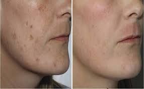 Side-by-side view of woman's face