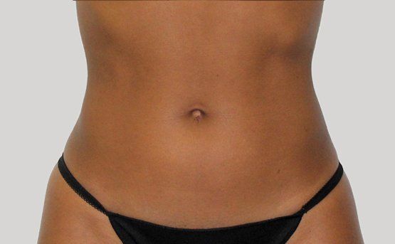Close-up of a person's torso, showing a toned abdomen and navel, with the edge of black underwear.