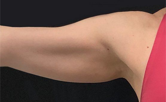 Arm with a smooth skin tone, reaching to the side. Red top is partially visible. Dark background.