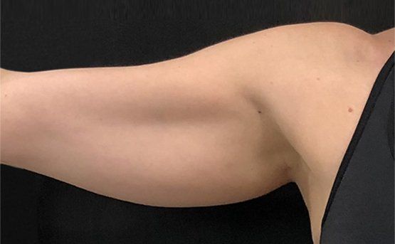 Woman's arm, side view, against a black background, skin toned, armpit visible, black tank top.