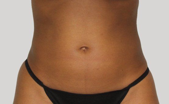 A person's bare torso with dark skin, wearing black underwear, against a gray backdrop.