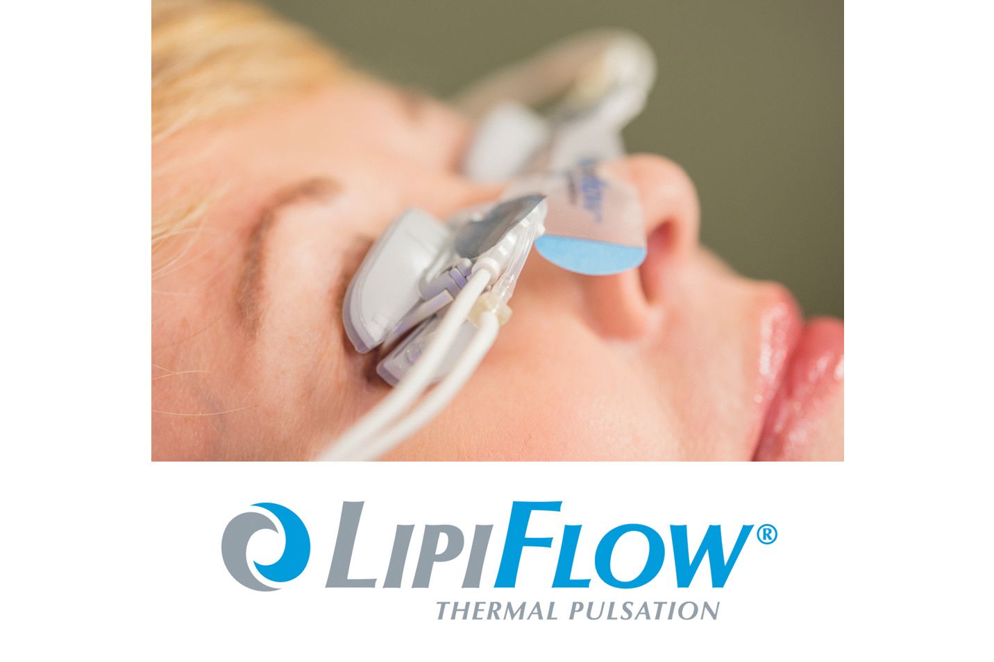 A woman is getting a lipiflow treatment on her face