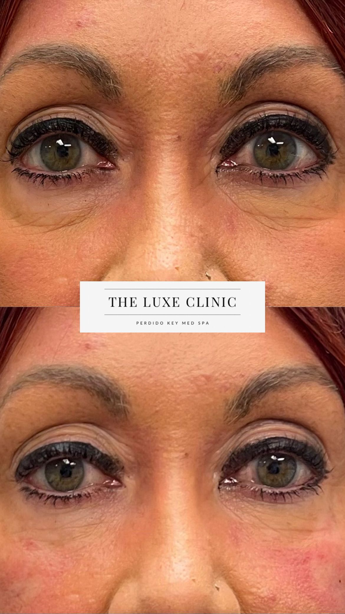 A before and after photo of a woman 's eyes.