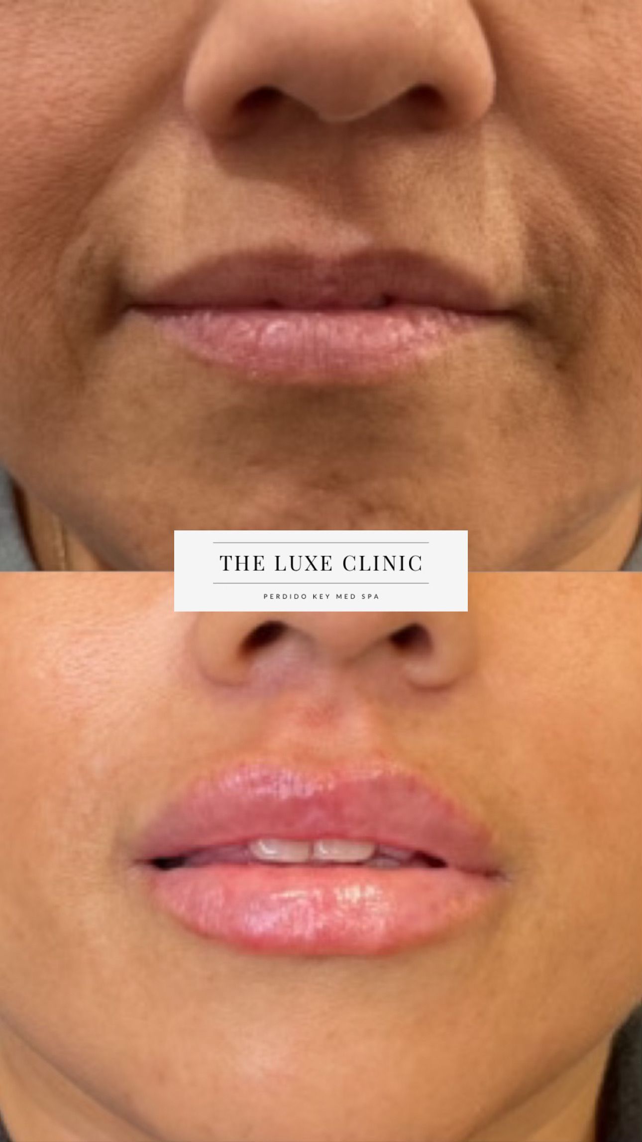 A before and after photo of a woman 's face