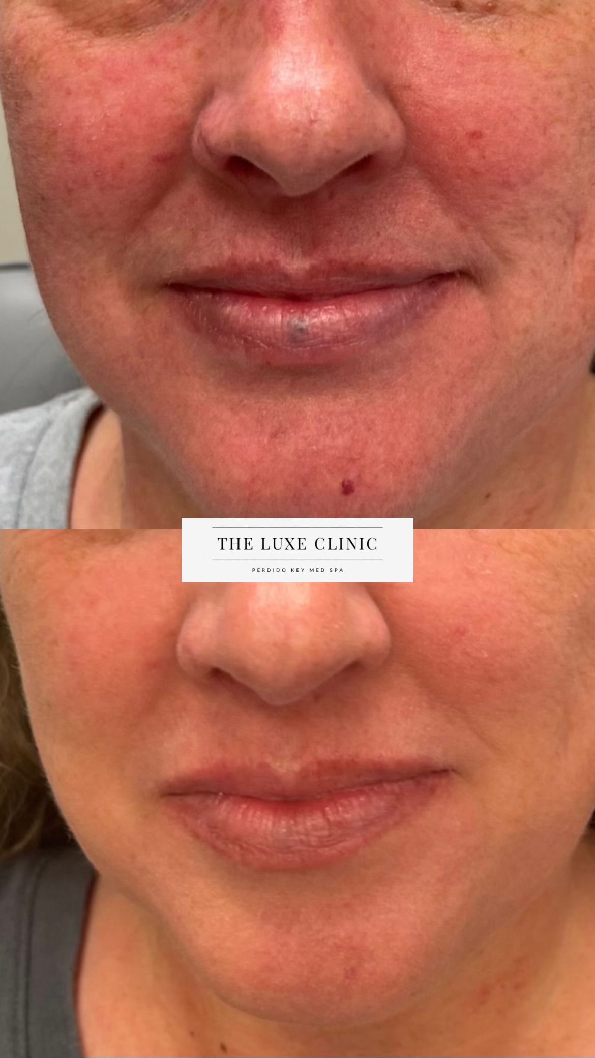 A before and after photo of a woman 's face.