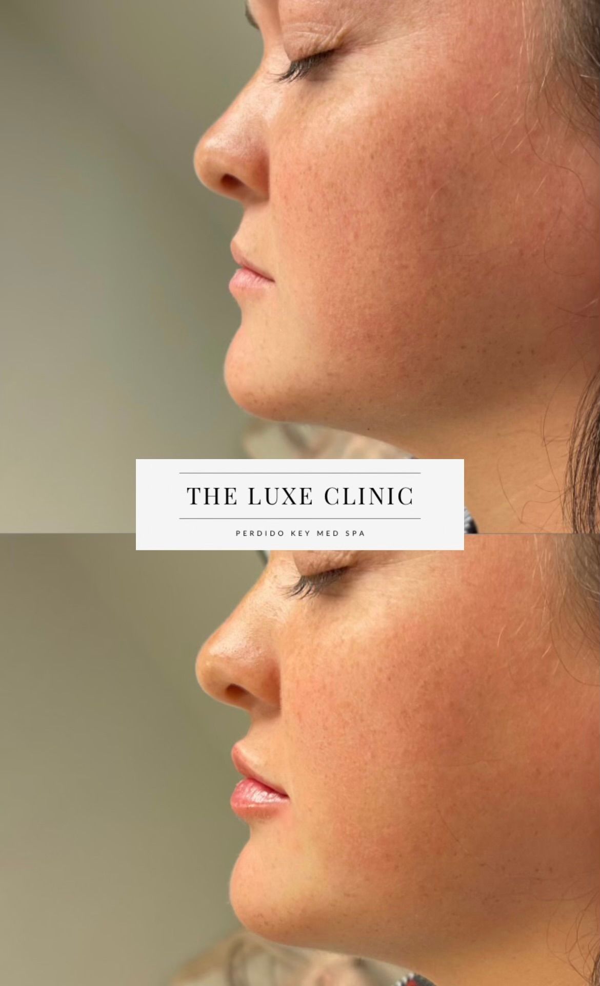 A before and after photo of a woman 's face.