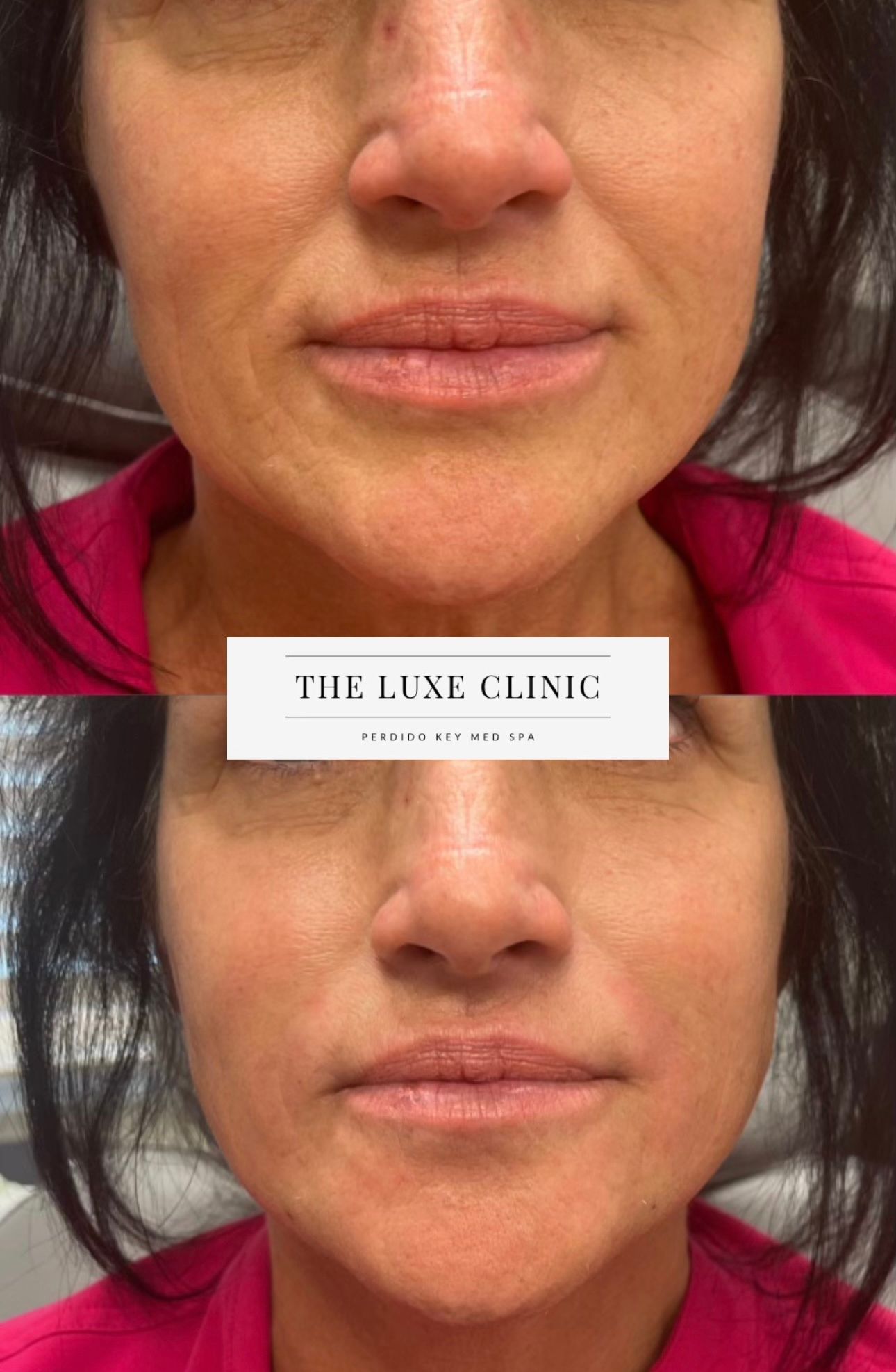 A before and after photo of a woman 's face.