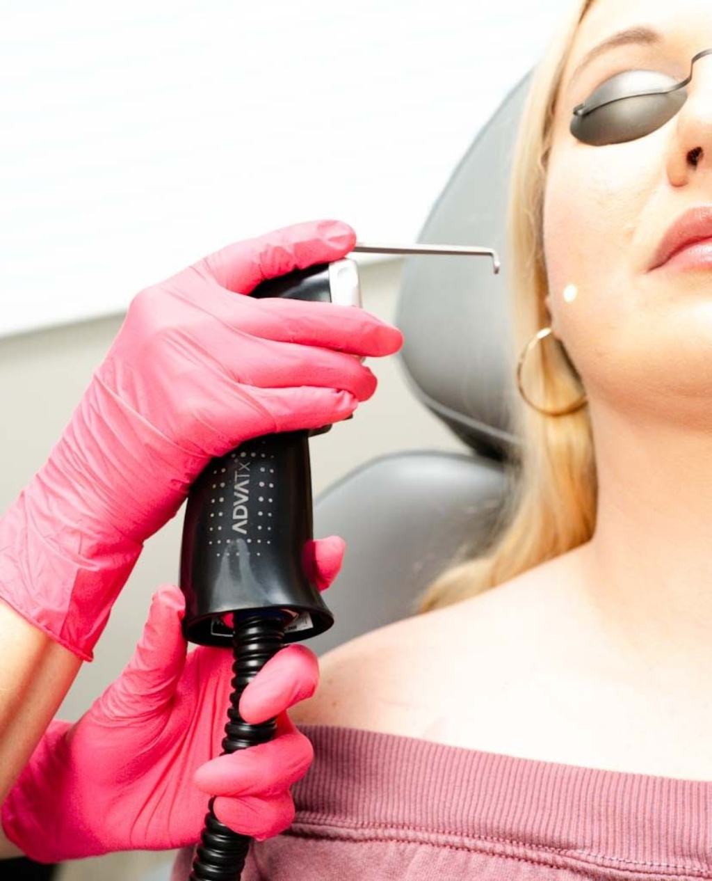 A woman is getting a laser treatment on her face