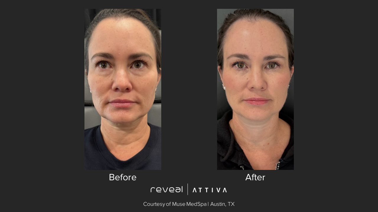 A before and after photo of a woman 's face