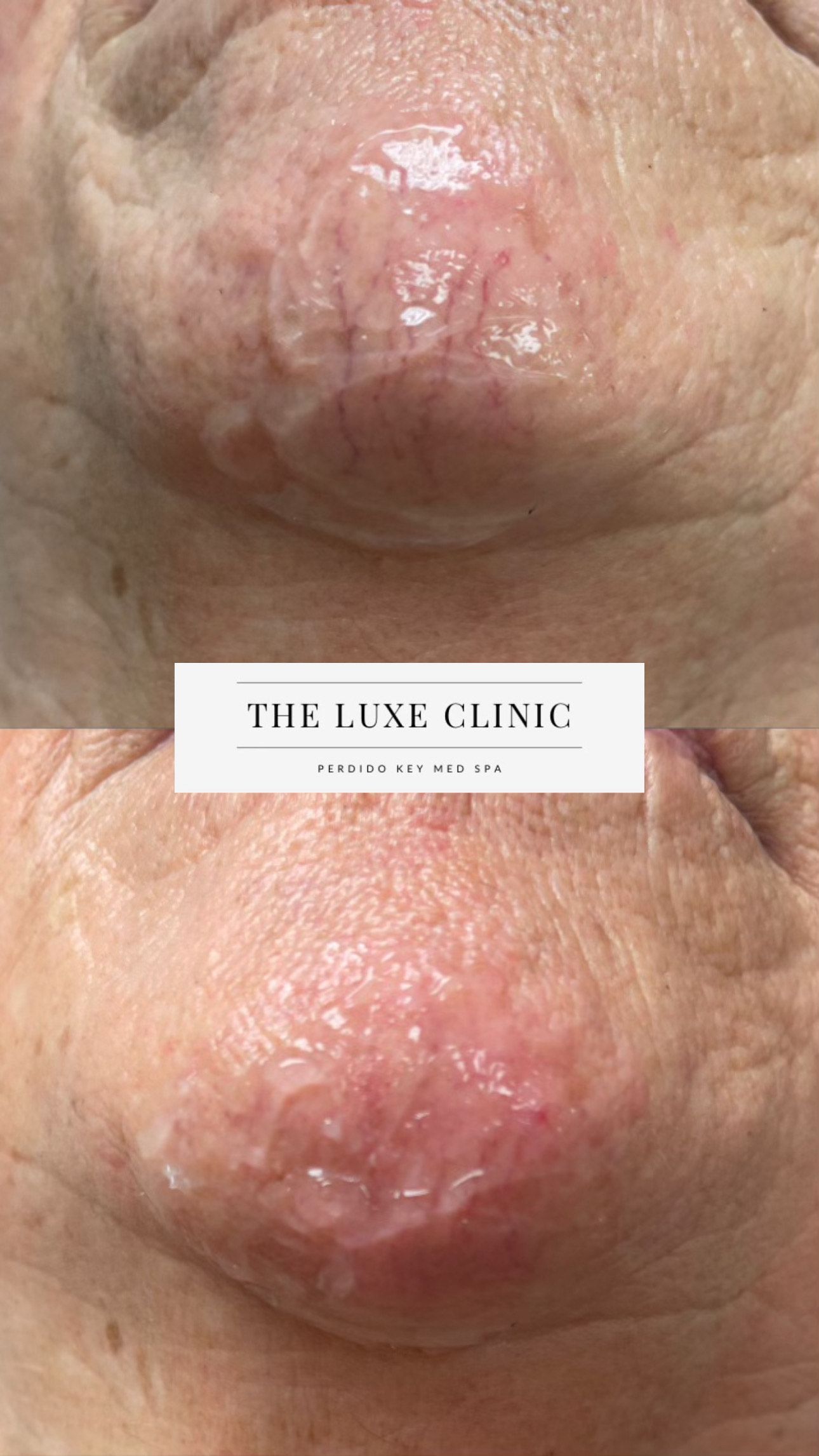 A before and after photo of a woman 's face.