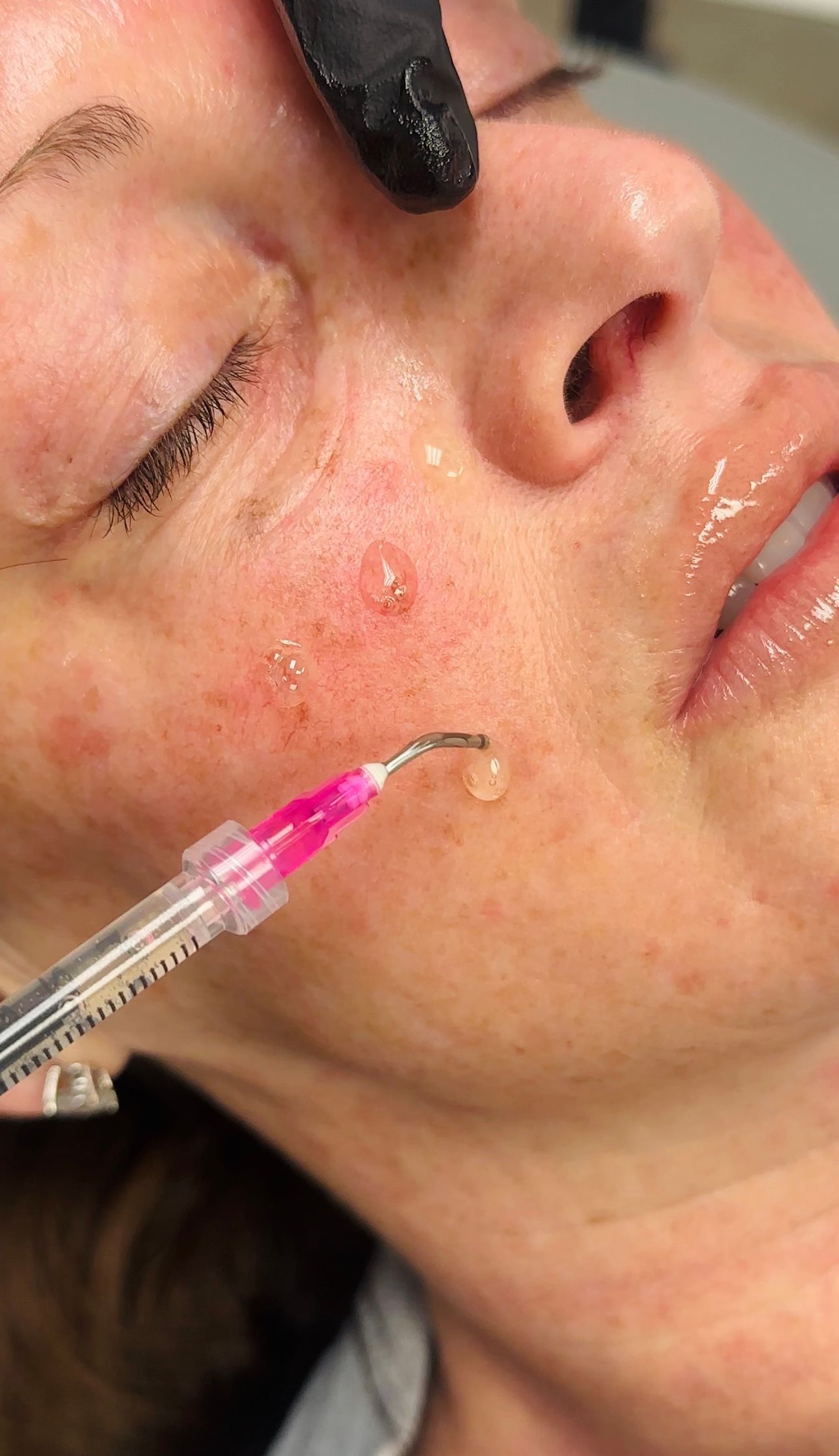 A woman is getting a facial treatment with a brush on her face